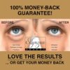 Eye Mask for Puffy Eyes - Dark Circles Under Eye Bags Treatment - 24k Gold Anti-Aging Under Eye Patches - Image 2